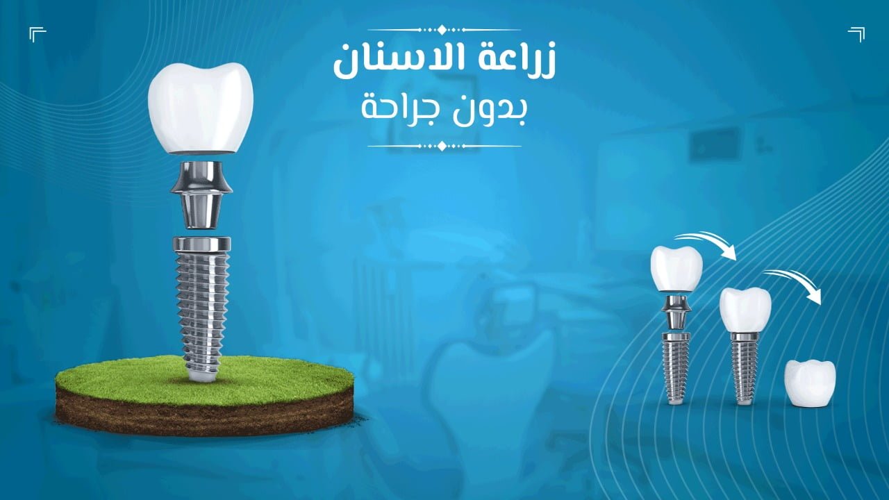 00a744d6 3693 4402 b262 5b5d954e4dc3