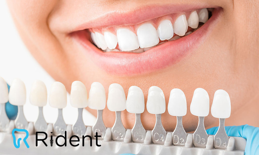 زراعة الأسنان (غرسات الأسنان) 1 زراعة