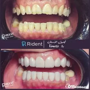 %D9%81%D9%8A%D9%86%D9%8A%D8%B1%D8%B2 %D8%A7%D9%84%D8%A3%D8%B3%D9%86%D8%A7%D9%86 11