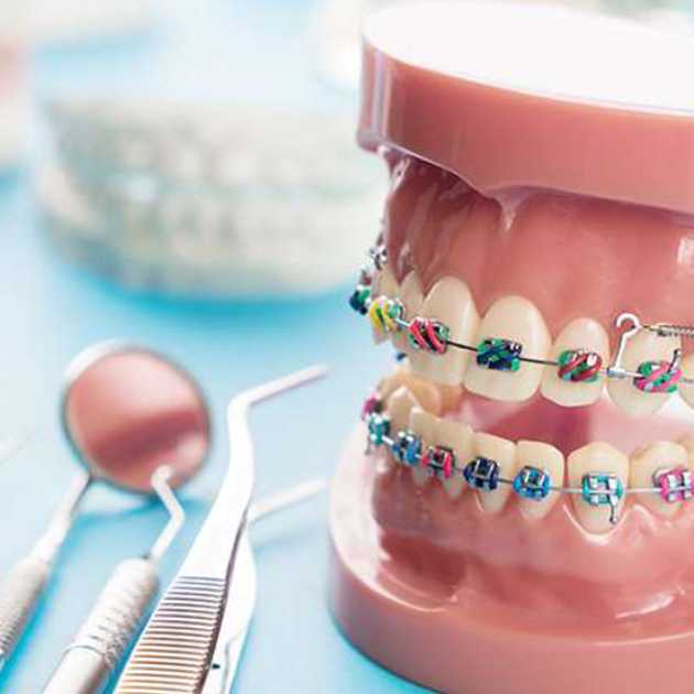 بدائل طربوش الأسنان .. 5 بدائل وما الأفضل من بينها؟ 3 بدائل طربوش الأسنان