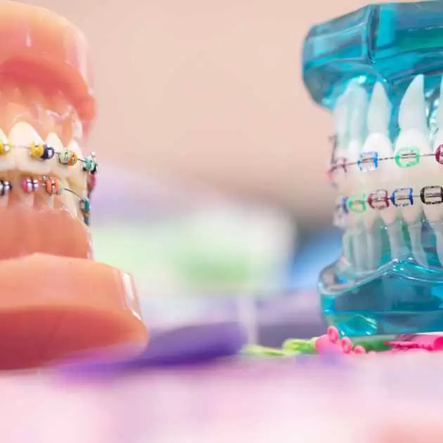 %D8%B3%D8%B9%D8%B1 %D8%AA%D9%82%D9%88%D9%8A%D9%85 %D8%A7%D9%84%D8%A3%D8%B3%D9%86%D8%A7%D9%86 1.jpg