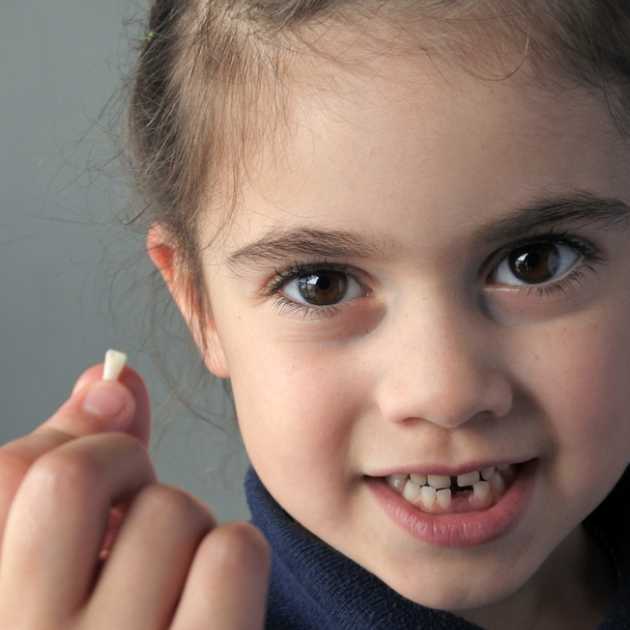 كل ما يهمك عن أسنان الأطفال عمر 6 سنوات 1 خلع