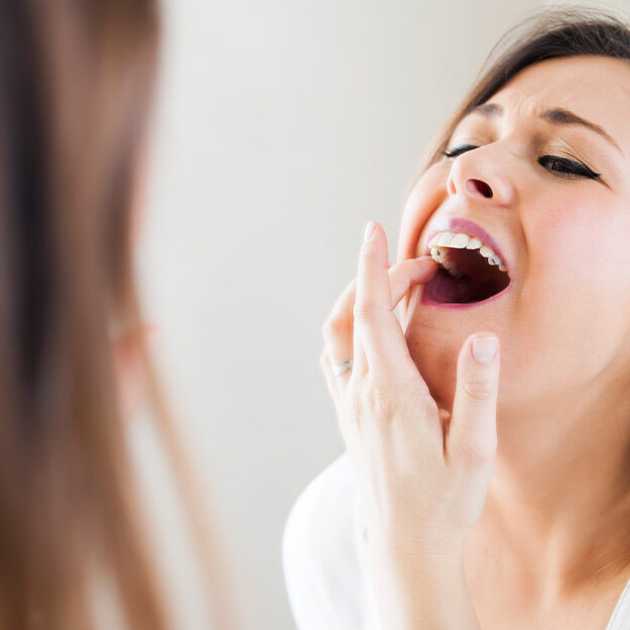 تسوس الاسنان الامامية