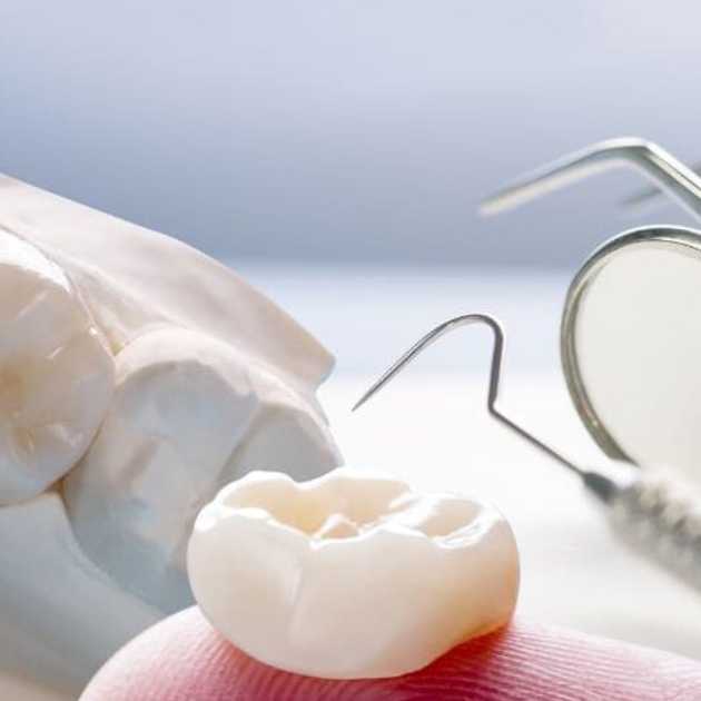 أنواع تركيبات الاسنان