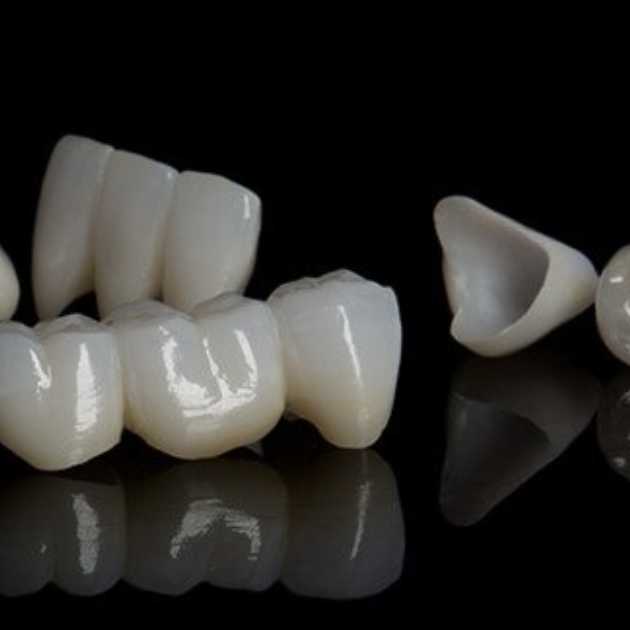 عيوب طربوش الأسنان و5 نصائح للتعامل معها 3 عيوب