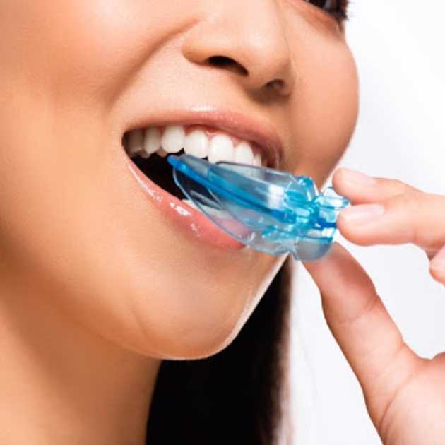 واقي الأسنان الليلي (2)