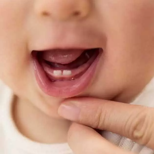 9 تساؤلات عن الاسنان اللبنية تهم كل أم 1 %D8%A7%D9%84%D8%A7%D8%B3%D9%86%D8%A7%D9%86 %D8%A7%D9%84%D9%84%D8%A8%D9%86%D9%8A%D8%A9 1.jpg