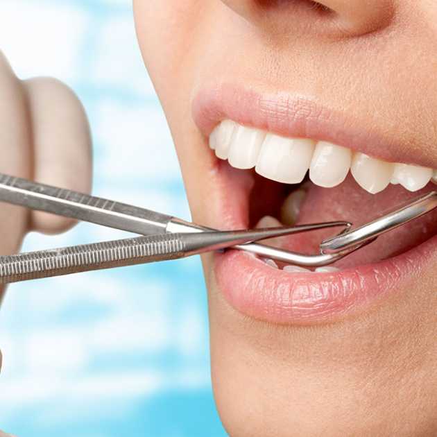 تنظيف الاسنان من الجير في 5 خطوات 3 تنظيف الاسنان من الجير (3)