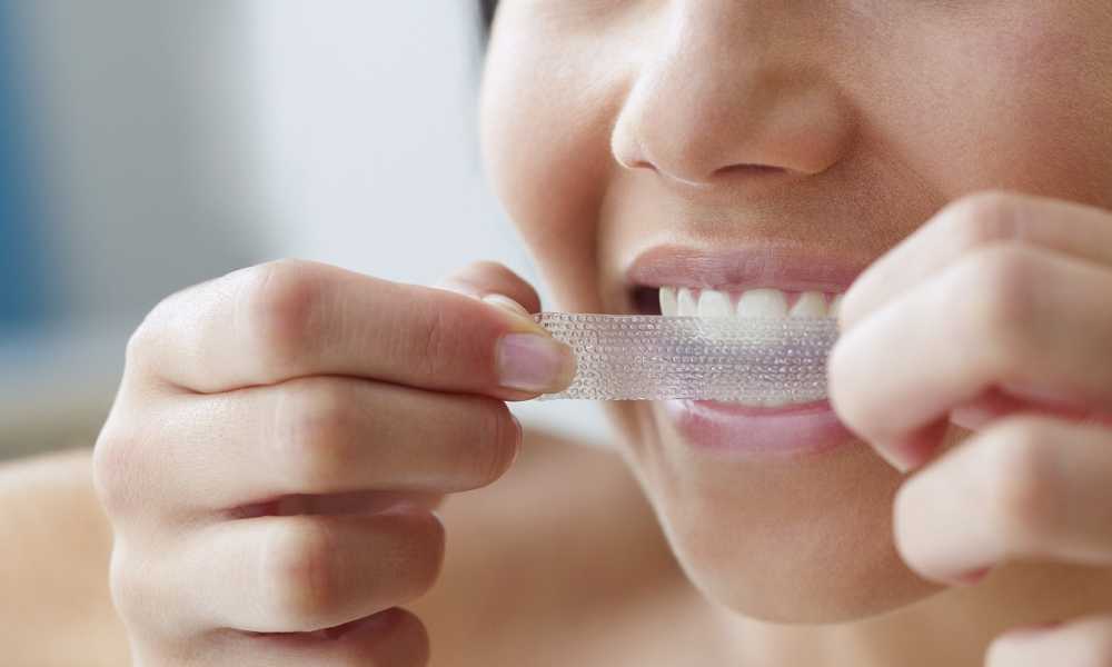 أنواع التهاب اللثة البسيط والشديد و8 طرق للعلاج 3 تنظيف الاسنان من الجير