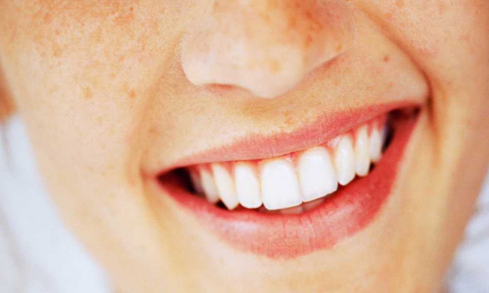 أهم 6 أسئلة وإجابات عن شكل الاسنان الطبيعي 7 شكل الاسنان الطبيعي