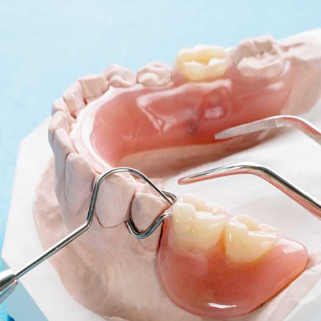 عيوب طقم الأسنان المتحرك و5 فوائد 1 عيوب طقم الأسنان المتحرك (1)