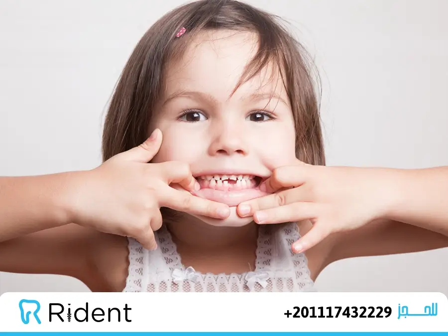 الاسنان اللبنية