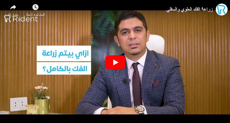 التحميل الفوري على التركيبات بعد زراعة الأسنان 5 Screenshot 6