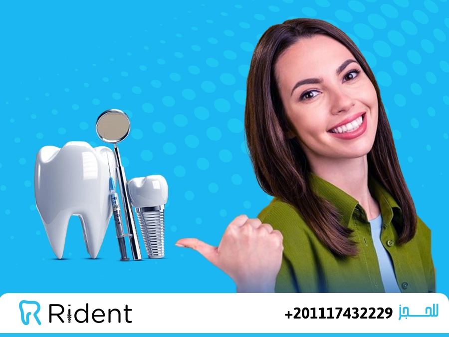 تجنب أخطاء زراعة الاسنان 