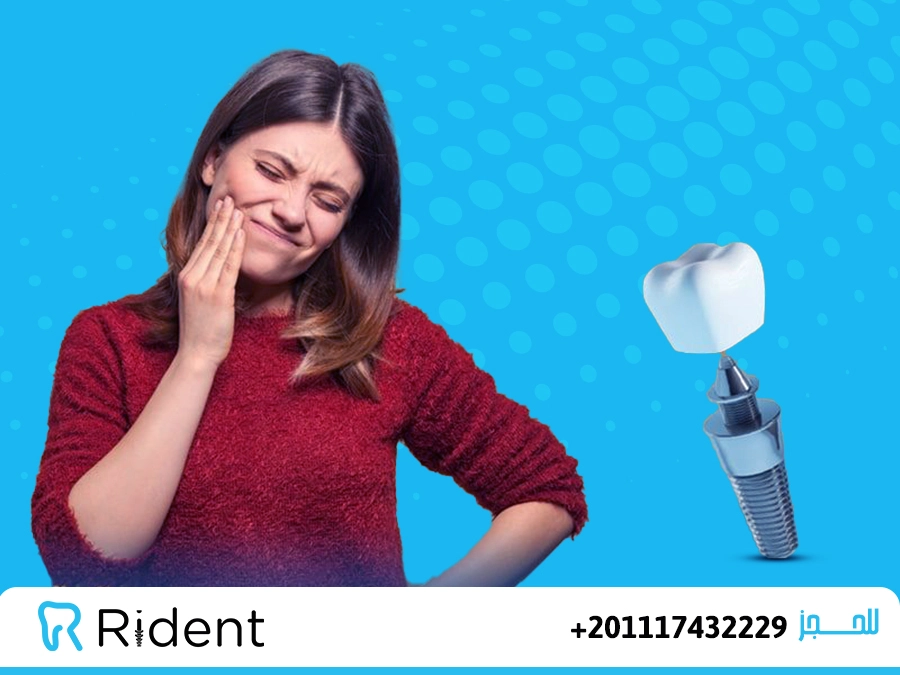 أخطاء زراعة الأسنان وكيفية تجنبها؟