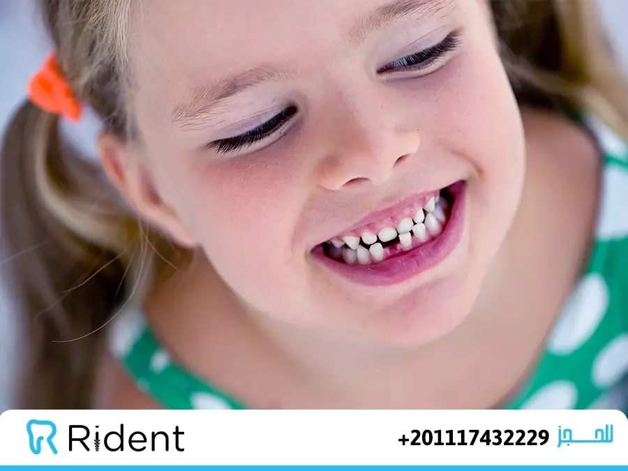 الضروس عند الأطفال