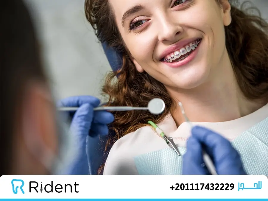 أفضل تقويم اسنان