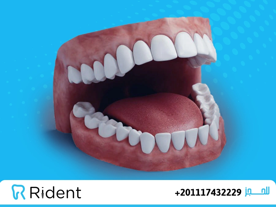 ابتسامة هوليود المتحركة