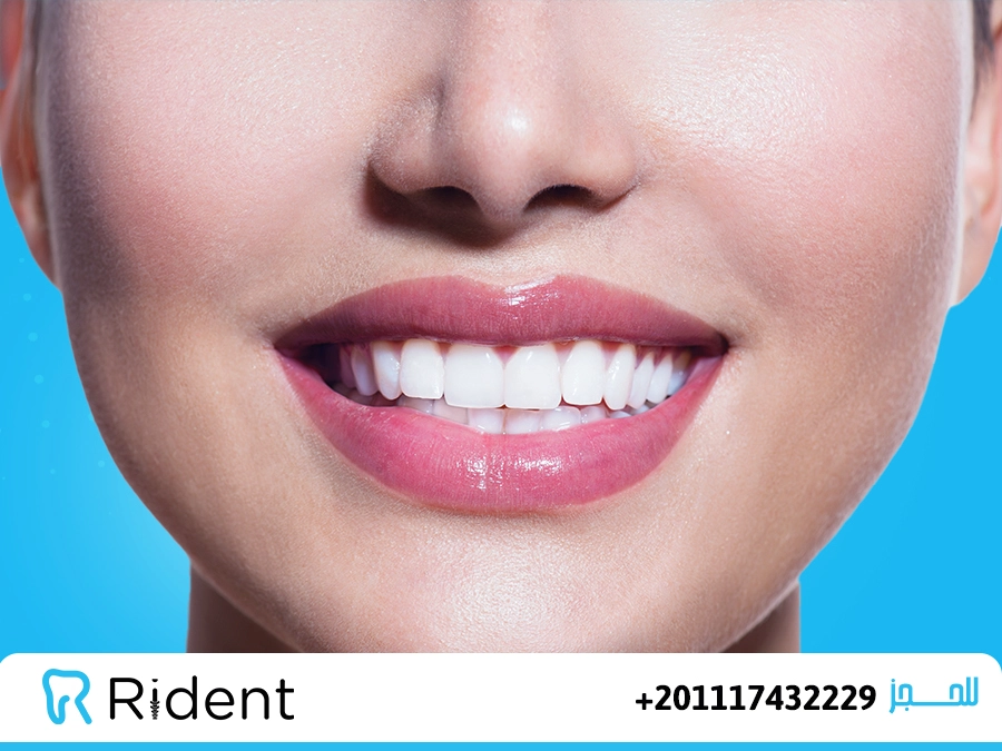 ابتسامة هوليود المتحركة 1 ابتسامة هوليود المتحركة 2023