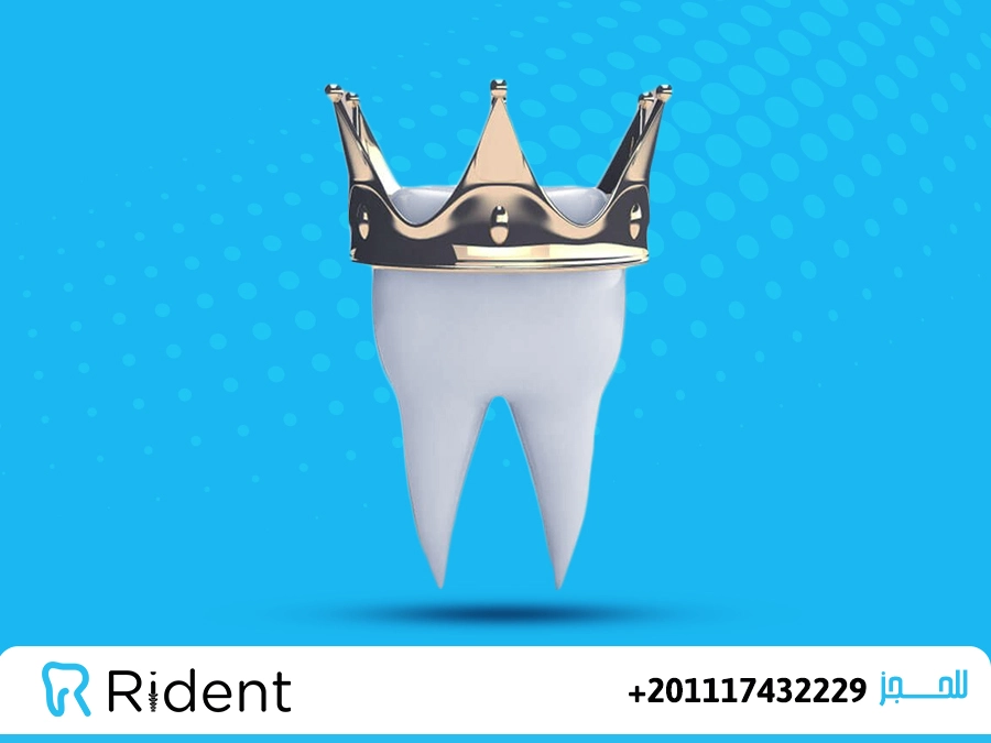 افضل دكتور اسنان في مصر