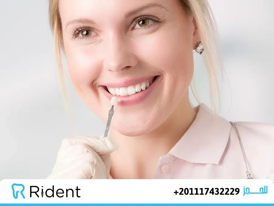 ابتسامة فينير