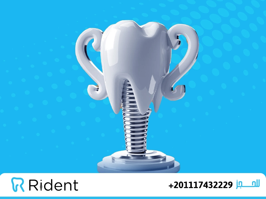 هل زراعة الاسنان مؤلمة ؟ , الفرق بين زراعة الأسنان الفورية والتقليدية