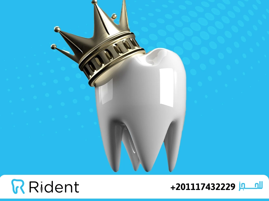 انواع ابتسامة هوليود