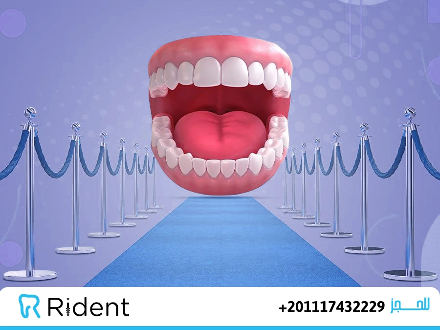  تجارب انواع ابتسامة هوليود 