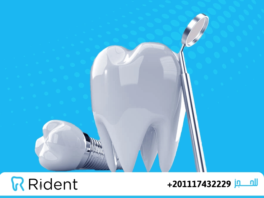 تأمين الاسنان 1 تأمين الاسنان