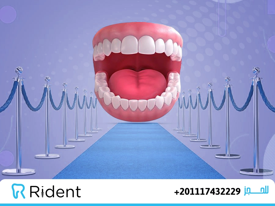 تجارب تركيب ابتسامة هوليود ونتائجها لدى السيدات والرجال 9 تجارب تركيب ابتسامة هوليود