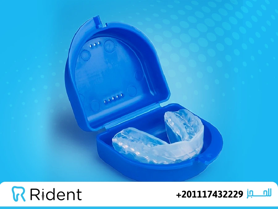 تجربتي مع التقويم الشفاف من البداية للنهاية 1 تجربتي مع التقويم الشفاف