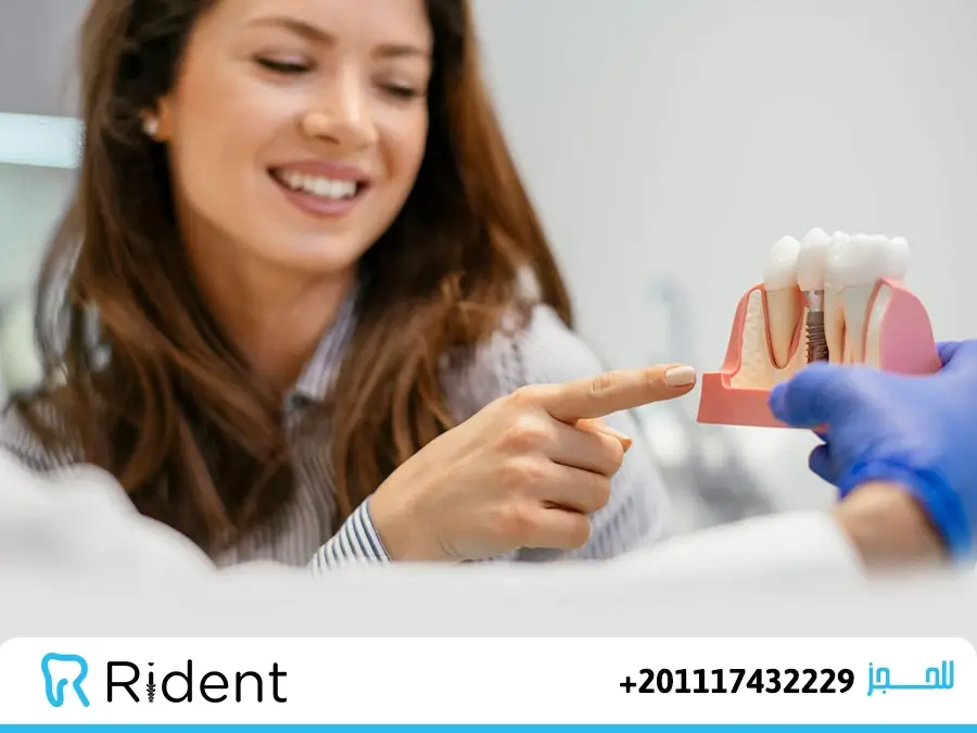 تجربتي مع زراعة الأسنان