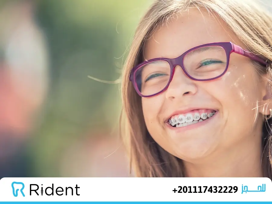 تقويم اسنان لابتسامة جذابة بسعر مناسب الآن للجميع 1 تقويم الأسنان