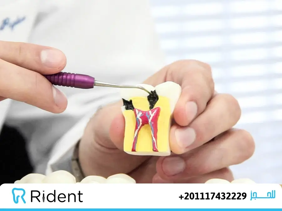 حشو الاسنان