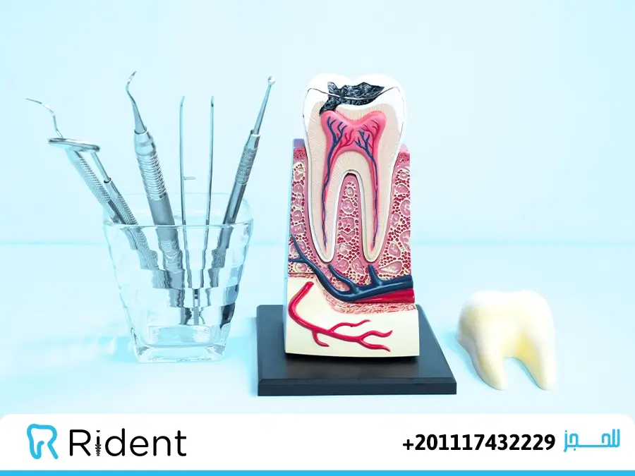 دواء مسكن ألم عصب الأسنان