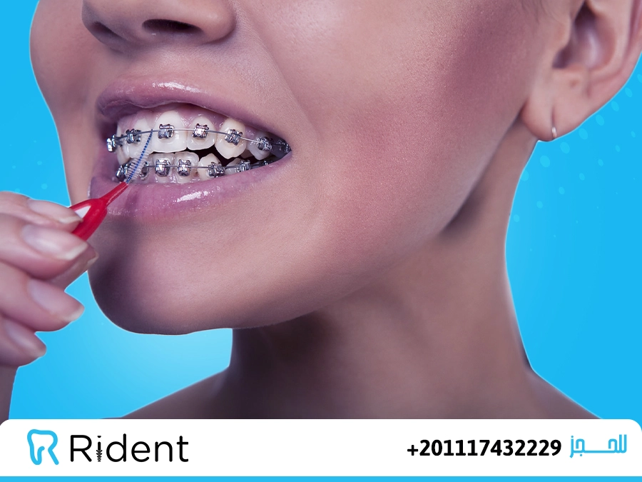 سعر التقويم الشفاف