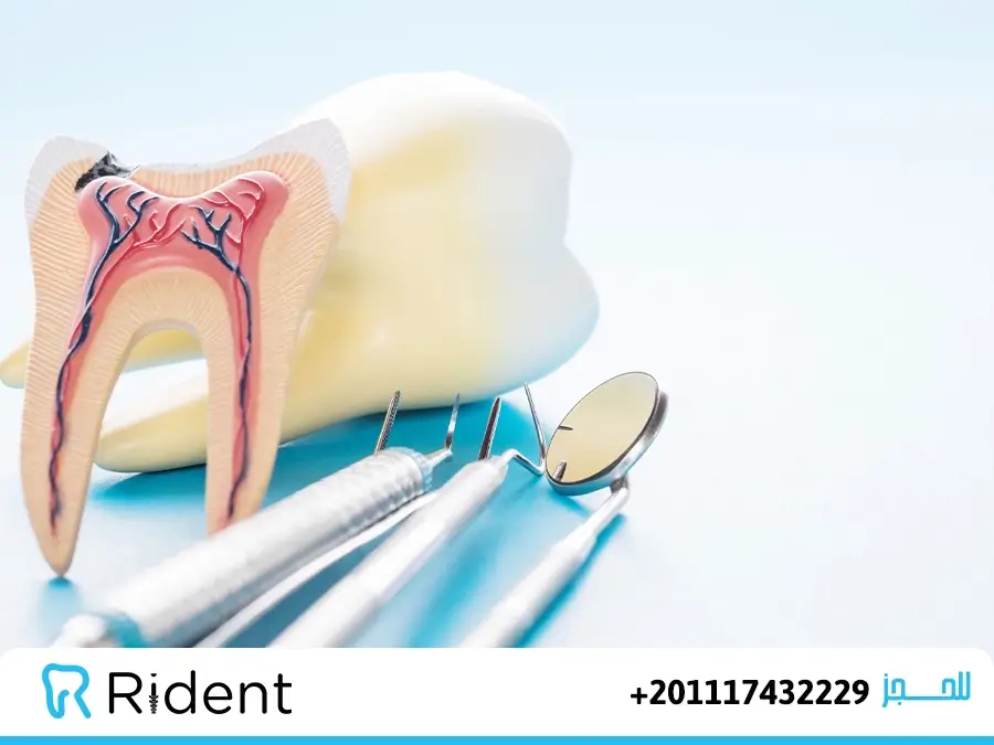 سعر حشو العصب