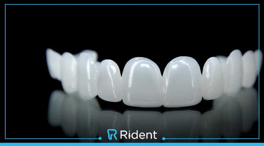 سناب اون سمايل | تمتع بابتسامة ساحرة بخطوات بسيطة 3 سناب اون سمايل