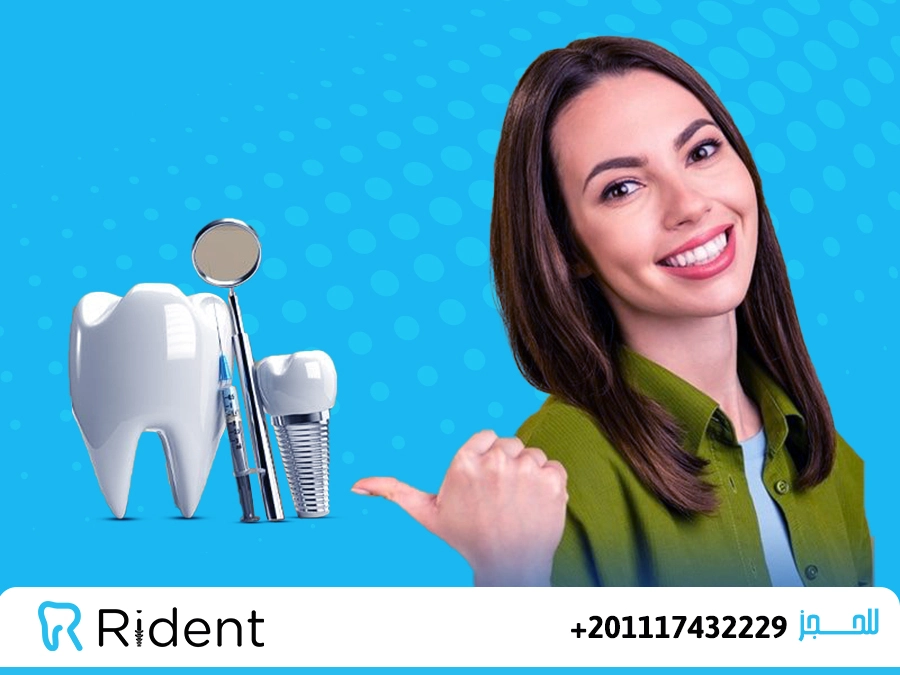 فوائد زراعة الاسنان واضرارها