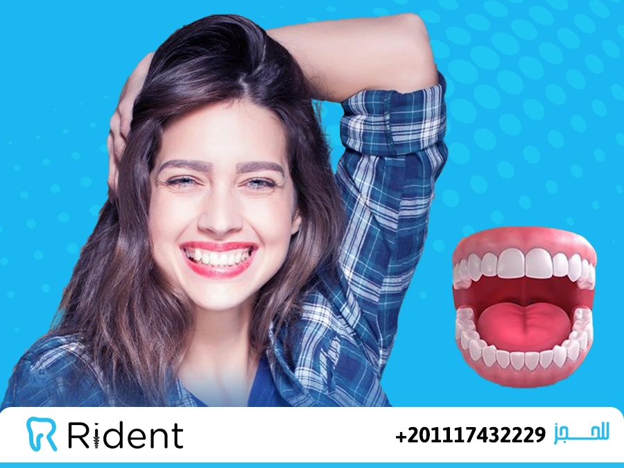 ما أسباب الابتسامة اللثوية