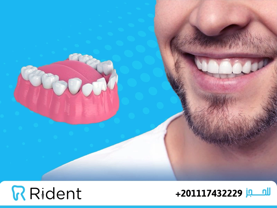 ما هي طرق تعديل الاسنان بدون تقويم