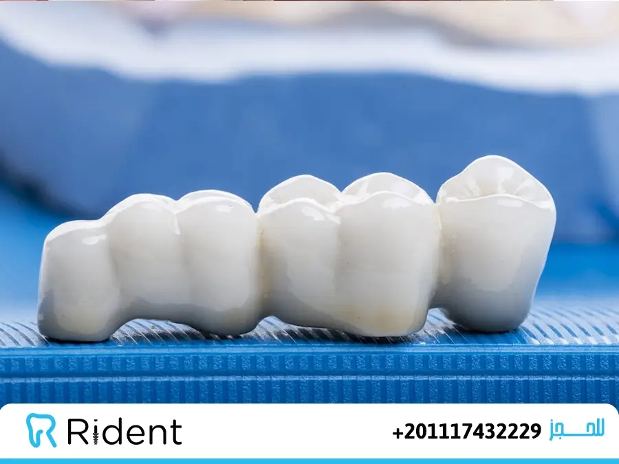 طربوش اسنان