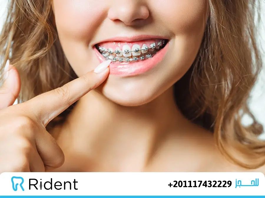 مركز تقويم الاسنان