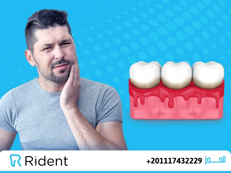 هل التهاب اللثة يسبب ألم الأسنان؟ 9 هل التهاب اللثة يسبب ألم الأسنان