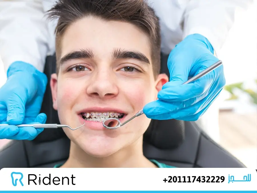 هل مدة تقويم الأسنان دوماً 12شهر؟