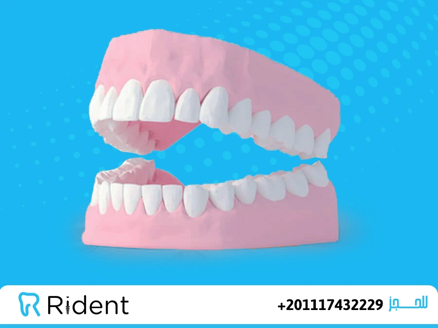 هل يساهم تنظيف الاسنان بالفحم في تبييض الأسنان؟ 1 هل يساهم تنظيف الاسنان بالفحم في تبييض الأسنان؟