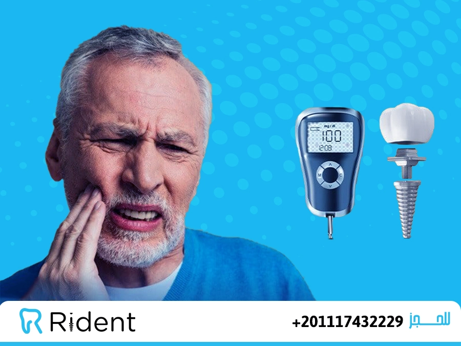 هل يمكن زراعة الاسنان لمرضى السكر؟ 8 هل يمكن زراعة الاسنان لمرضى السكر